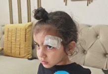 बच्चे की आंख में लगी चोट, डॉक्टर बोला- जाओ 5 वाला फेविक्विक ले आओ, फिर टांके की जगह लगा दिया गोंद